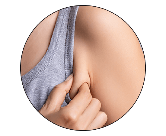 How Do I Get Rid of Armpit Fat/Bra Bulge?