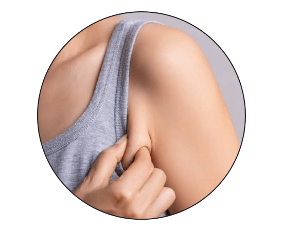 What is Axillary Fat, and How Can It Be Removed?