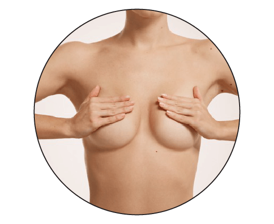 Fixing Breast Asymmetry: Your Options