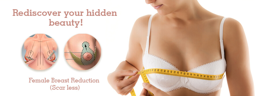 Natural Breast Lift Methods, Breast Lift in Delhi