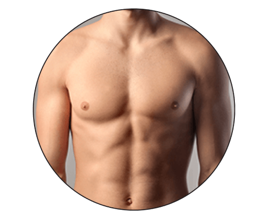 Gynecomastia Surgery Male Breast Reduction Dezire Clinic 