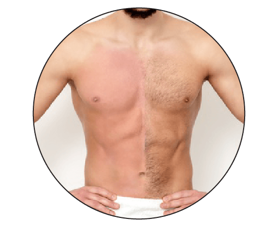 Men epilation deals