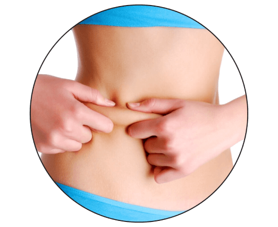 Waist - Love Handles Liposuction