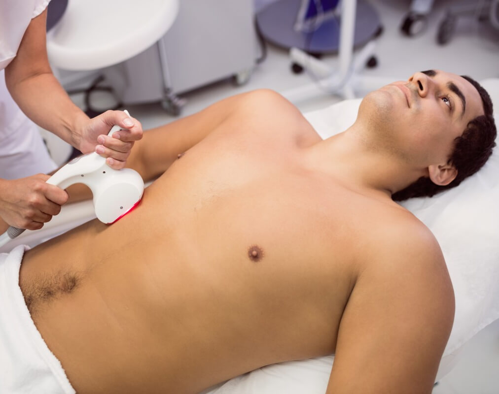 Male Lower Abdomen Laser Hair Removal