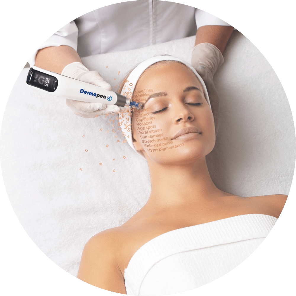 dermapen 4 microneedling